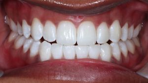 Orthodontics