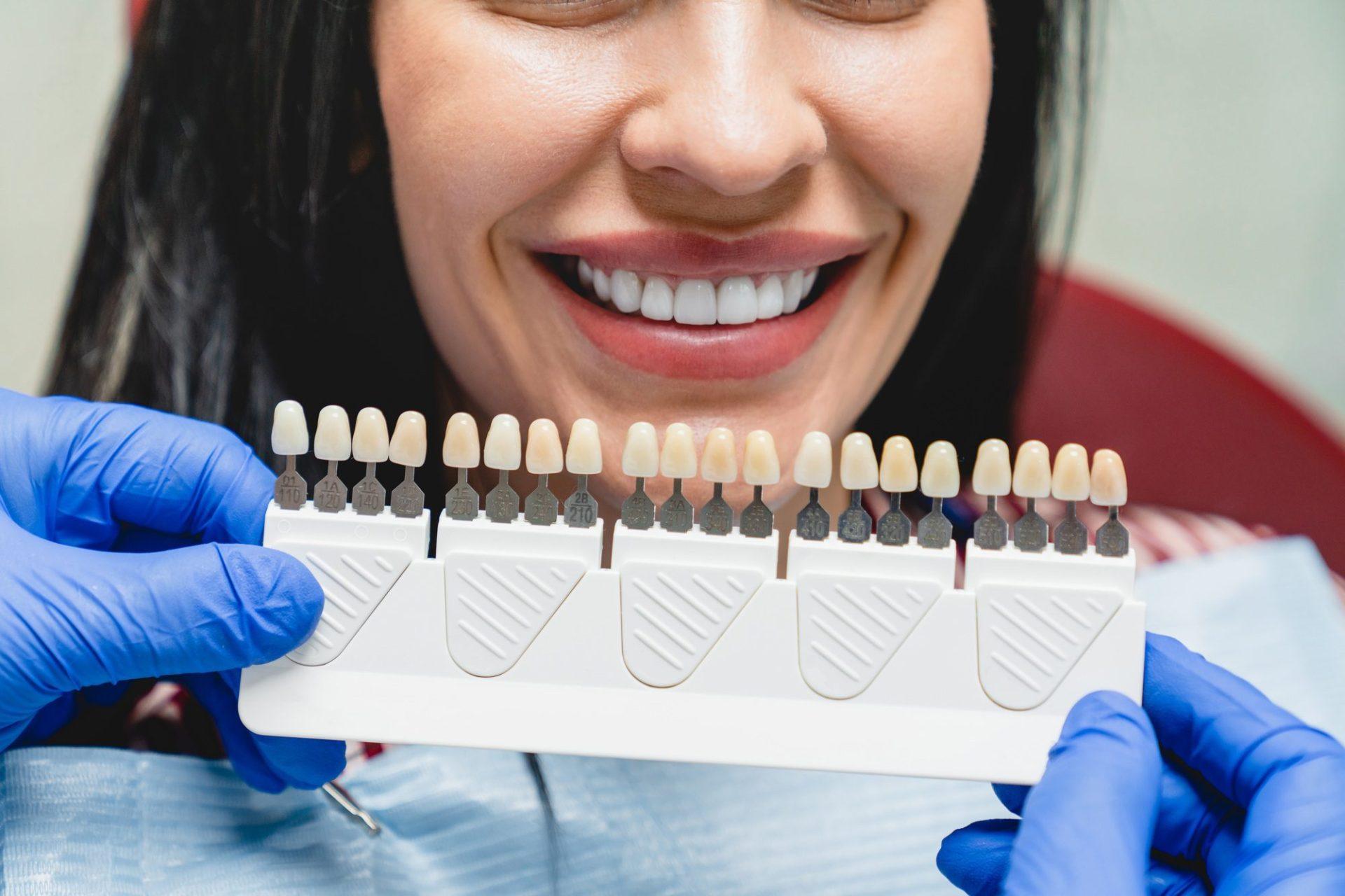 whitening concept dental care implants veneers woman with perfect smile choosing teeth tooth tone