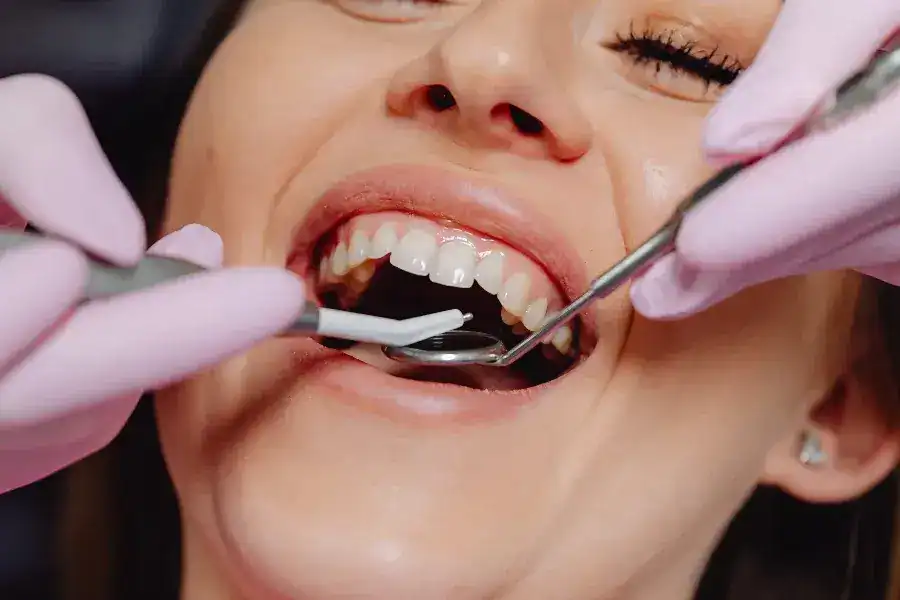 Tooth Implants 30 Step-by-Step Process for Getting a Single Tooth Implant