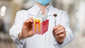 Root Canal Treatment
