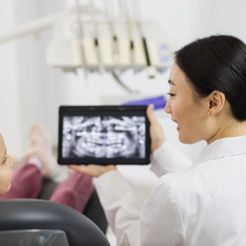 Children’s Dental 17 Root Canal Treatment