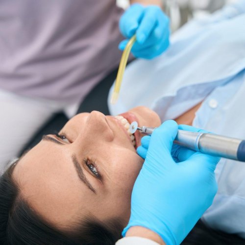 dental fillings