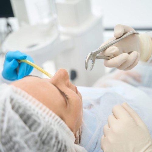 Teeth Extractions