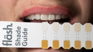 How Long Do Teeth Whitening Results Typically Last? 1 Teeth Whitening