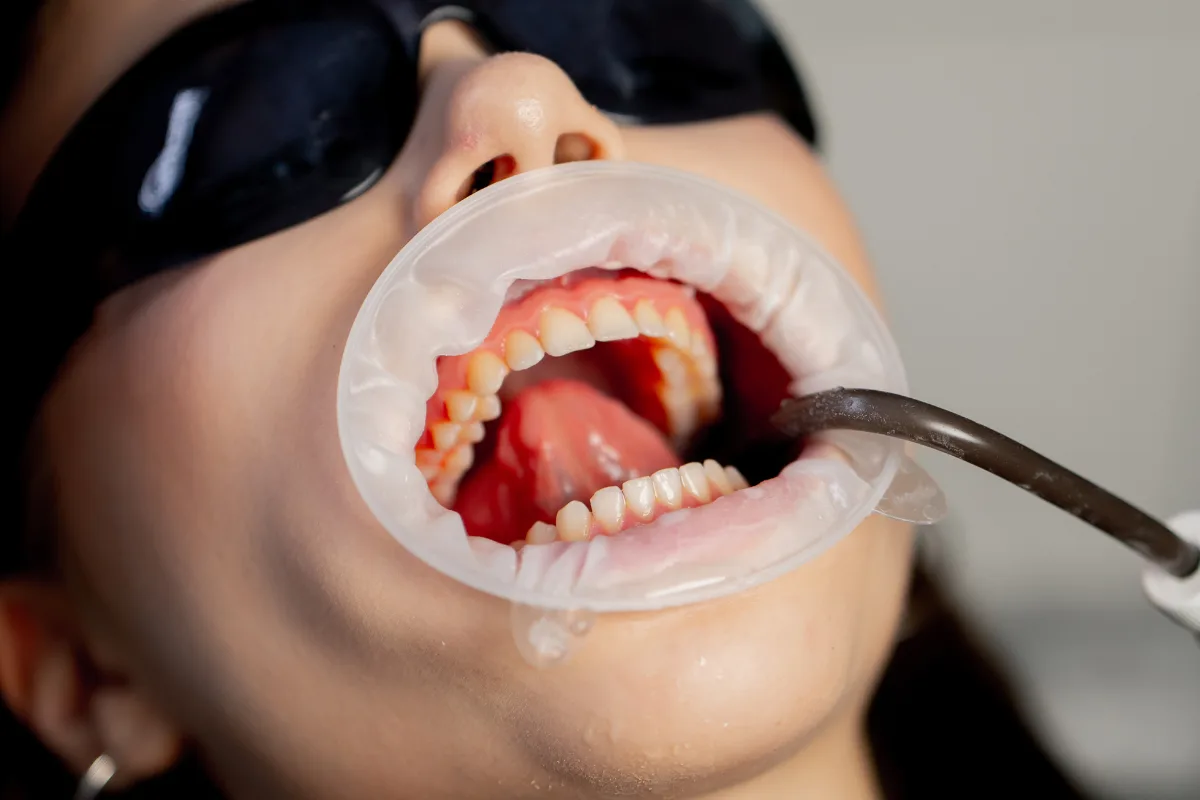 General Dentistry