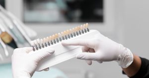 Dental Veneers 