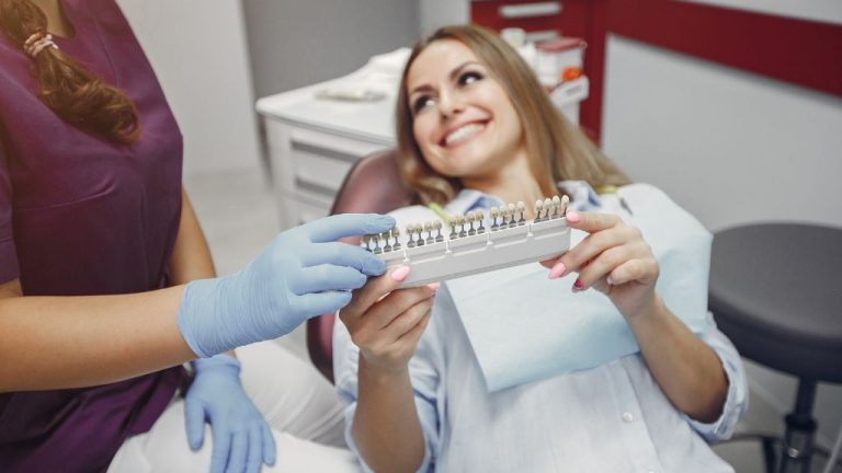 Dental Veneers