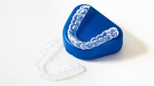 Clear Aligners