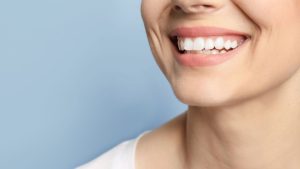 Orthodontic