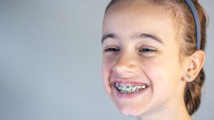 Braces for Kids