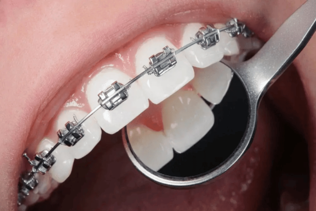 Free Orthodontics Consultation