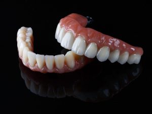 How do All-on-6 implants restore a full smile? 1 Full Mouth Implants