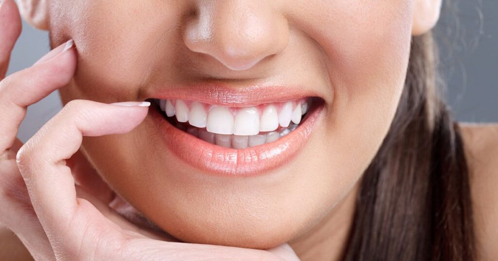 Education 26 Teeth Whitening