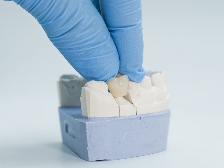 Dental Crown