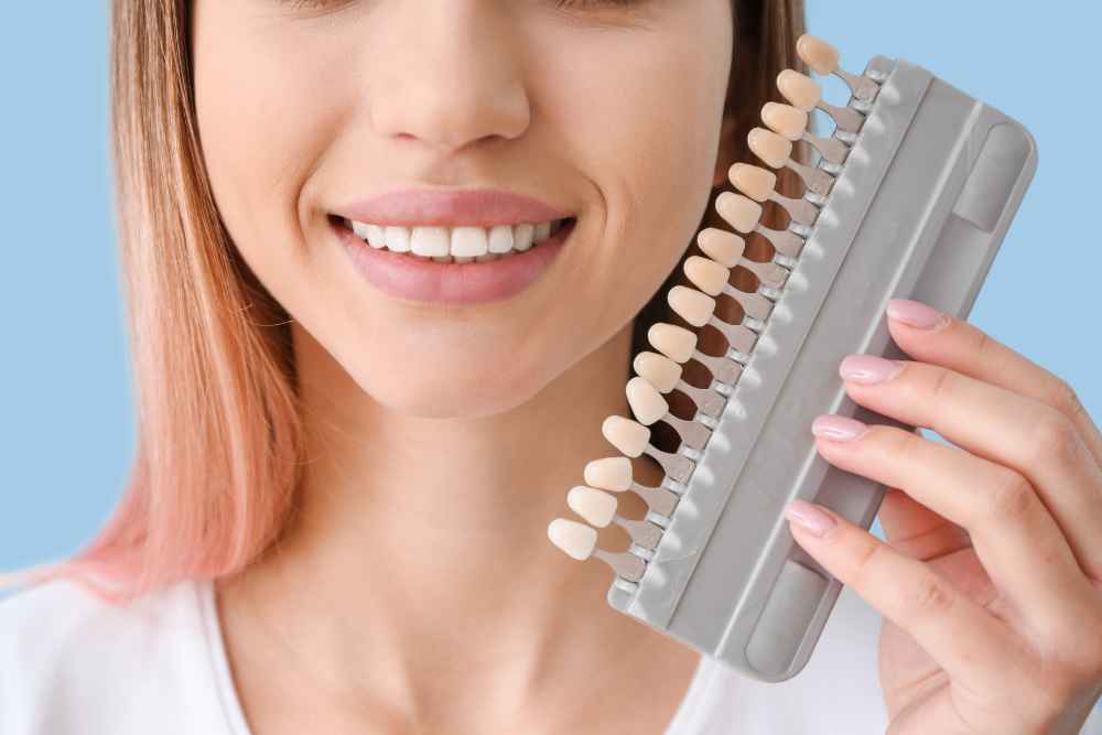 Composite Veneer