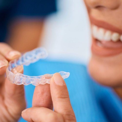 close-up-of-woman-using-orthodontic-night-guard-for-her-teeth--r8e7wk28z5107kjj9x0hsev69f4hdapvc4wmlk8io8