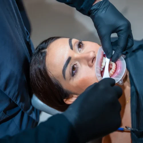 Cosmetic Dentistry