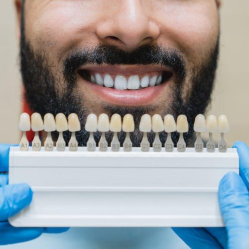 dental care implants for veneers man with perfect smile choosing teeth tooth tone at dental clinic