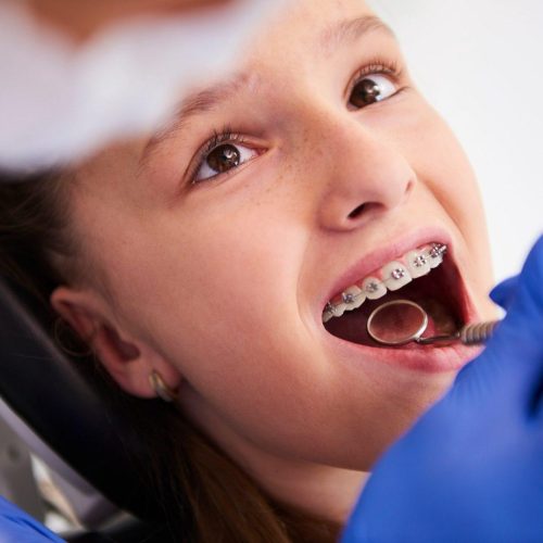 girl with braces during a routine dental examination