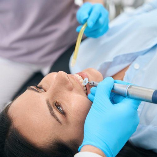 dental fillings