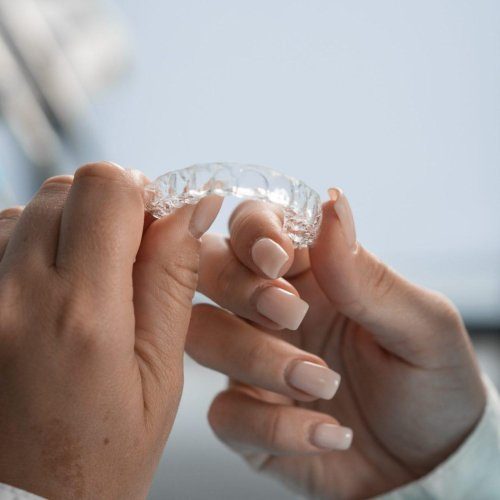 the-dentist-carefully-holds-the-mouth-guard-in-his-hands-preparing-for-the-procedure-and-r8e7wx7zmtj0q40f52p9rbjmktbmd2641y1fbfp094